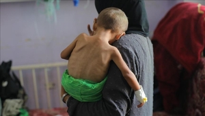 Gaza.. The number of deaths from Israeli starvation rises to 422, including 145 children.